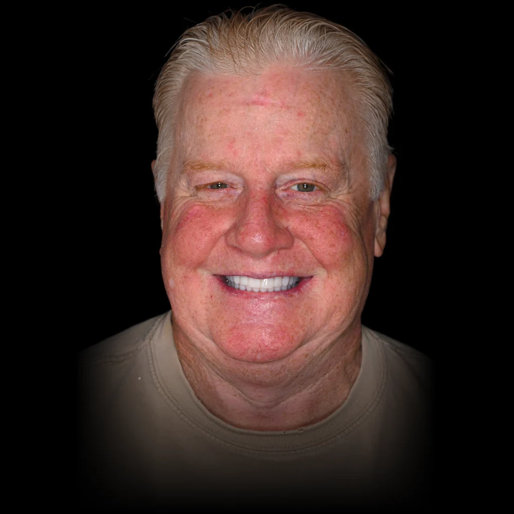 Patient smiling after all on 4 dental implants at PRACTICENAME