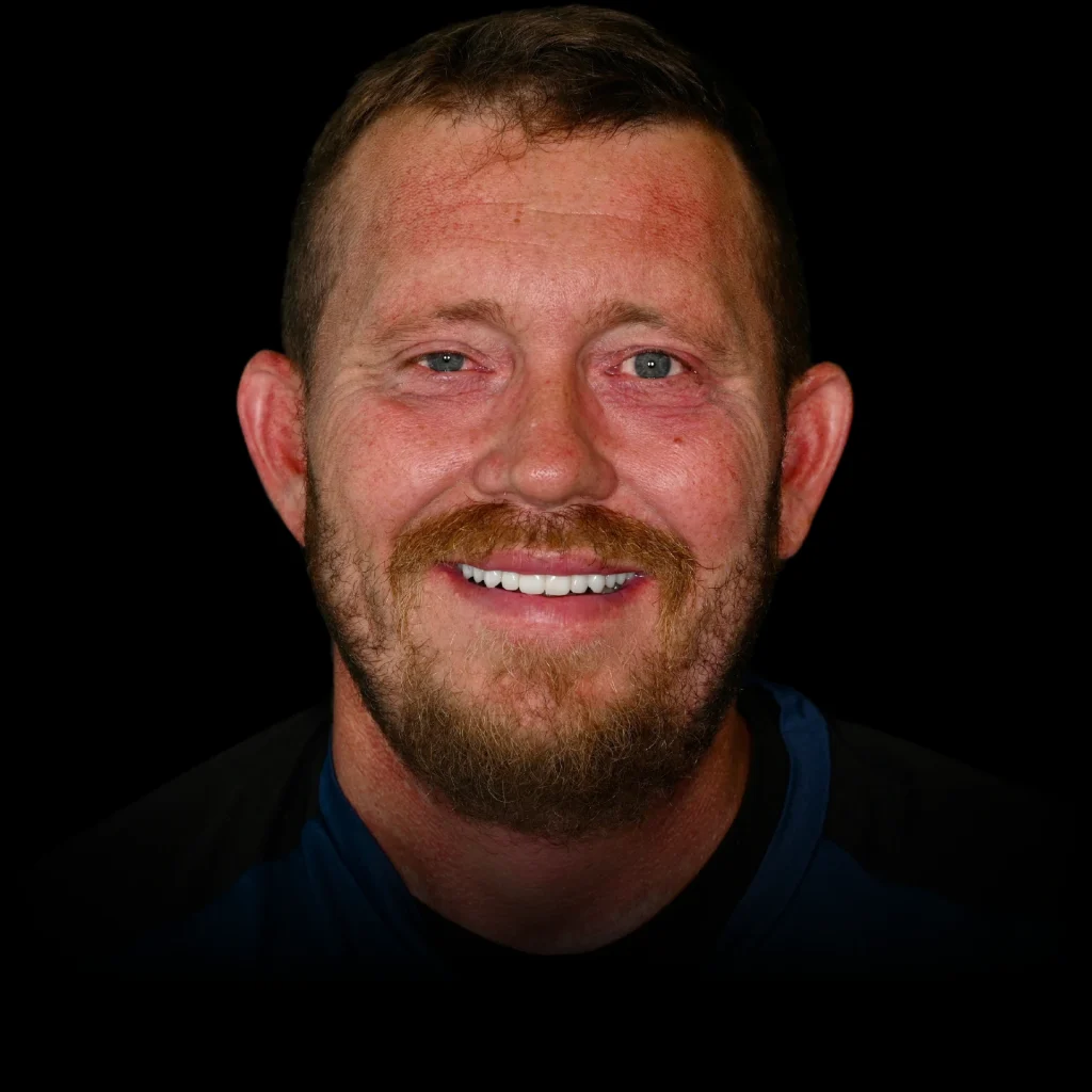 Patient smiling after all on 4 dental implants at PRACTICENAME