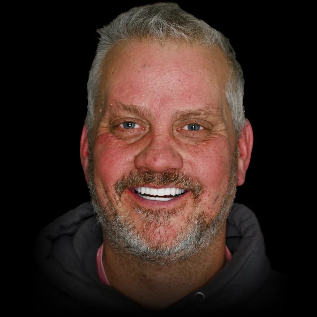 Patient smiling after all on 4 dental implants at PRACTICENAME